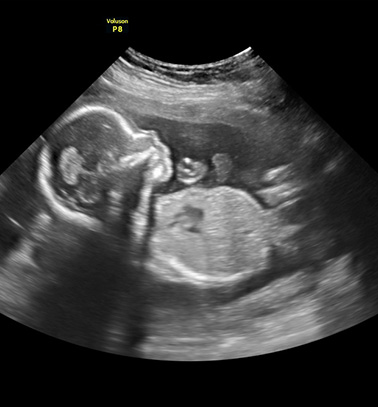 Little Gram 2D Image