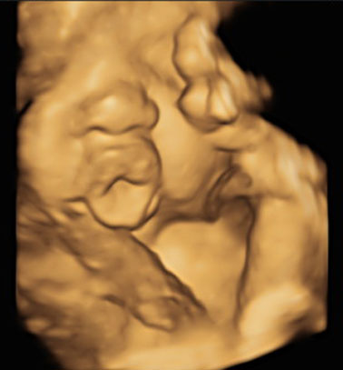 Little Gram 3D Image