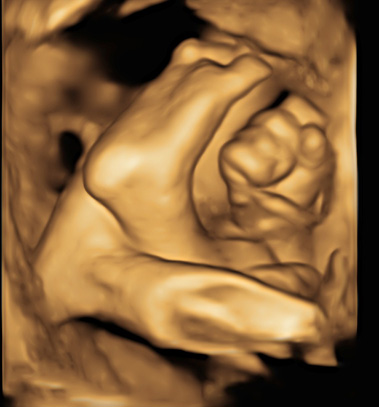 Little Gram 3D Image