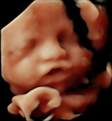 Little Gram HD Live or 5D Image