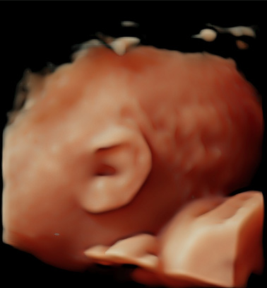 Little Gram HD Live or 5D Image