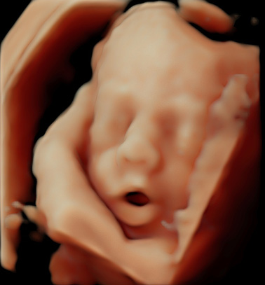 Little Gram HD Live or 5D Image