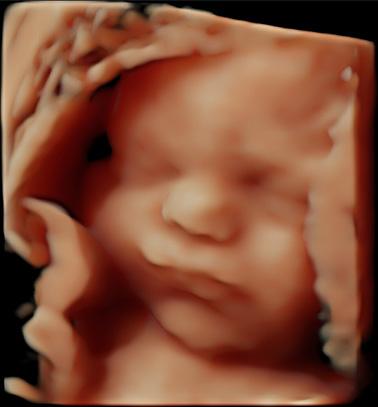 Little Gram HD Live or 5D Image