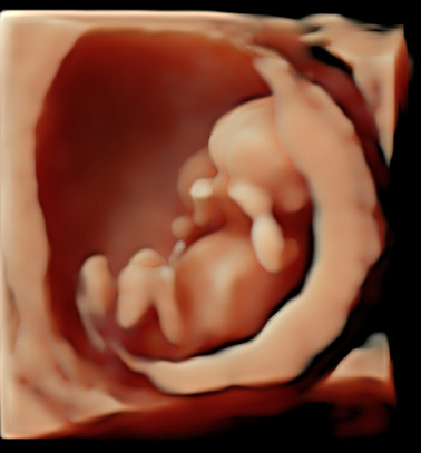 Little Gram HD Live or 5D Image